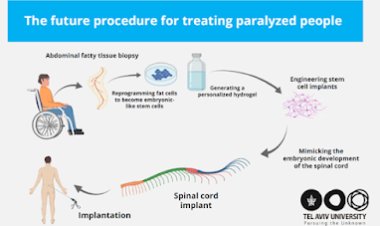 Israel’s TAU Breakthrough Offers New Hope to Help People with Paralysis Walk Again